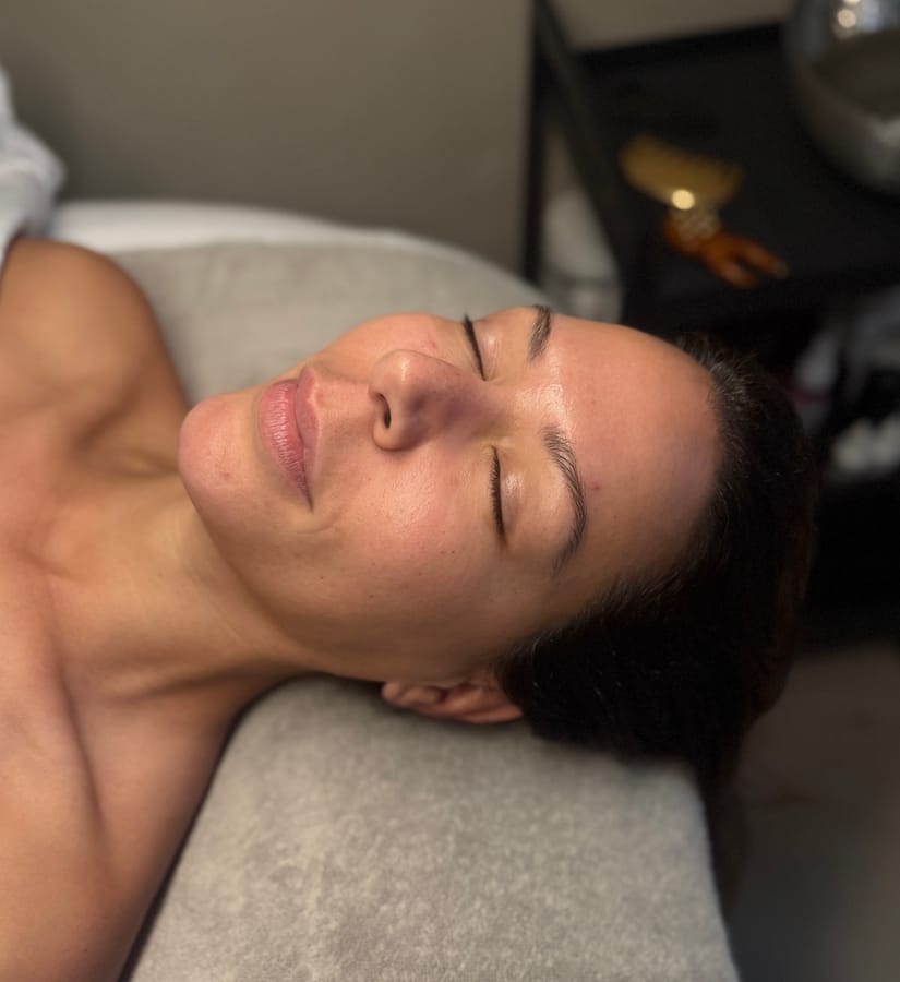 Before facial sculpting session